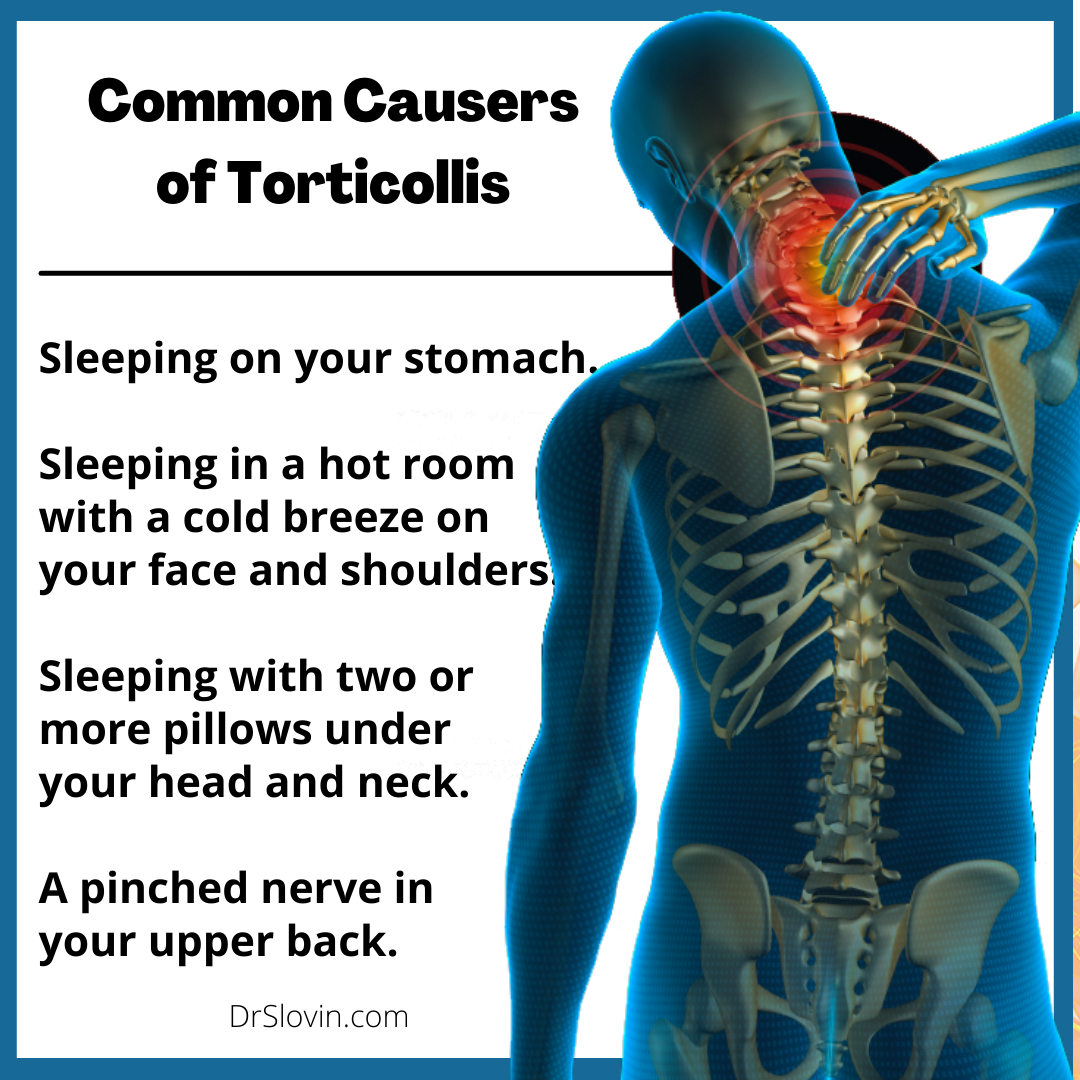 https://www.drslovin.com/wp-content/uploads/2021/08/Common-Causers-of-Torticollis.png